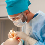 What to Expect from FUE Hair Transplants